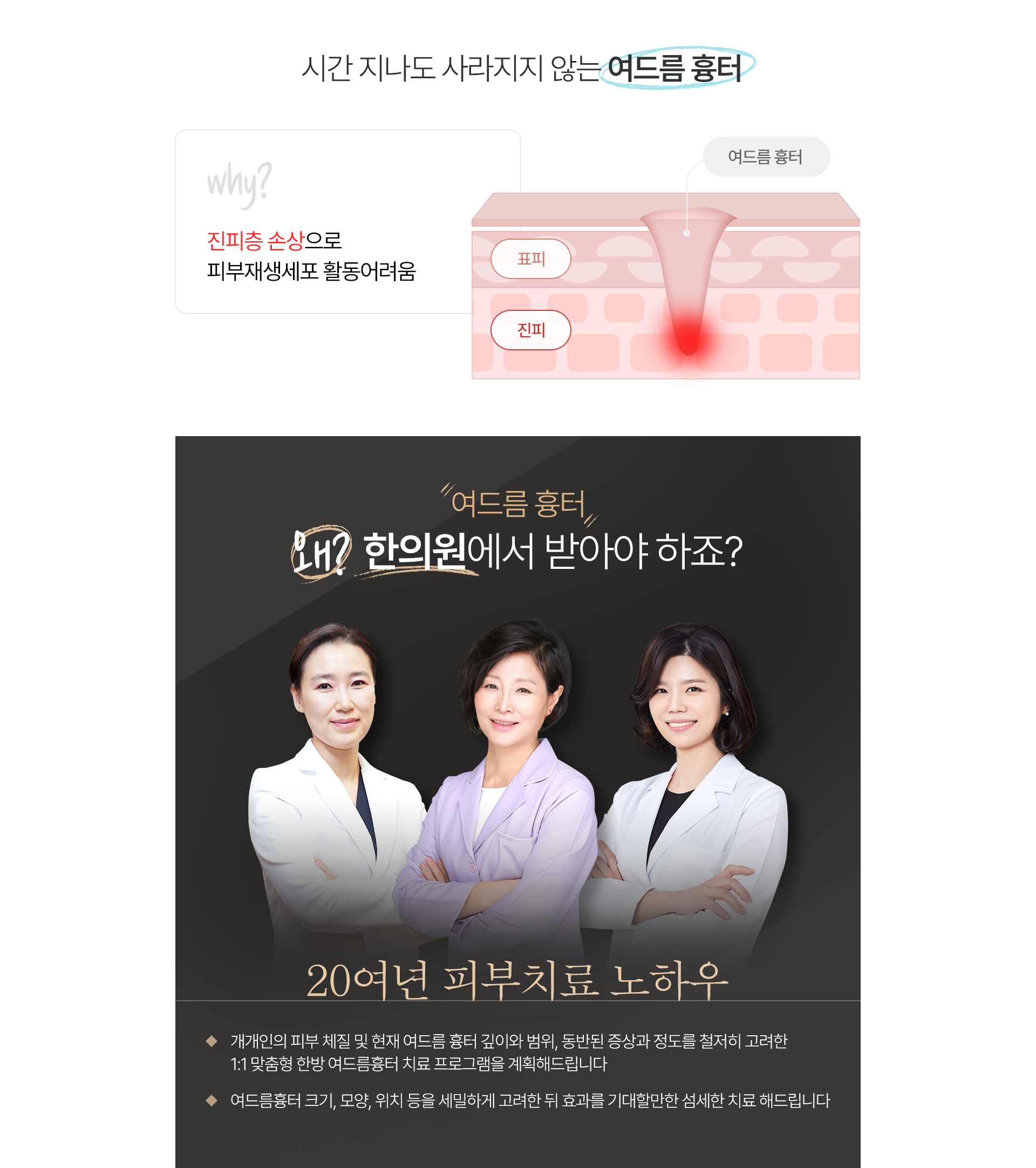 흉터,자국 치료